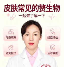 皮肤常见的赘生物，一起来了解